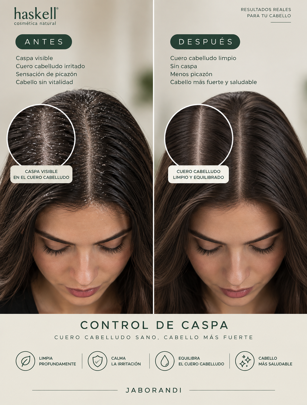 Caspa