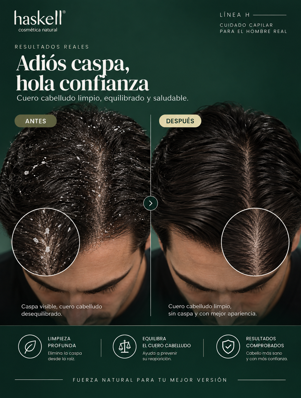 Caspa